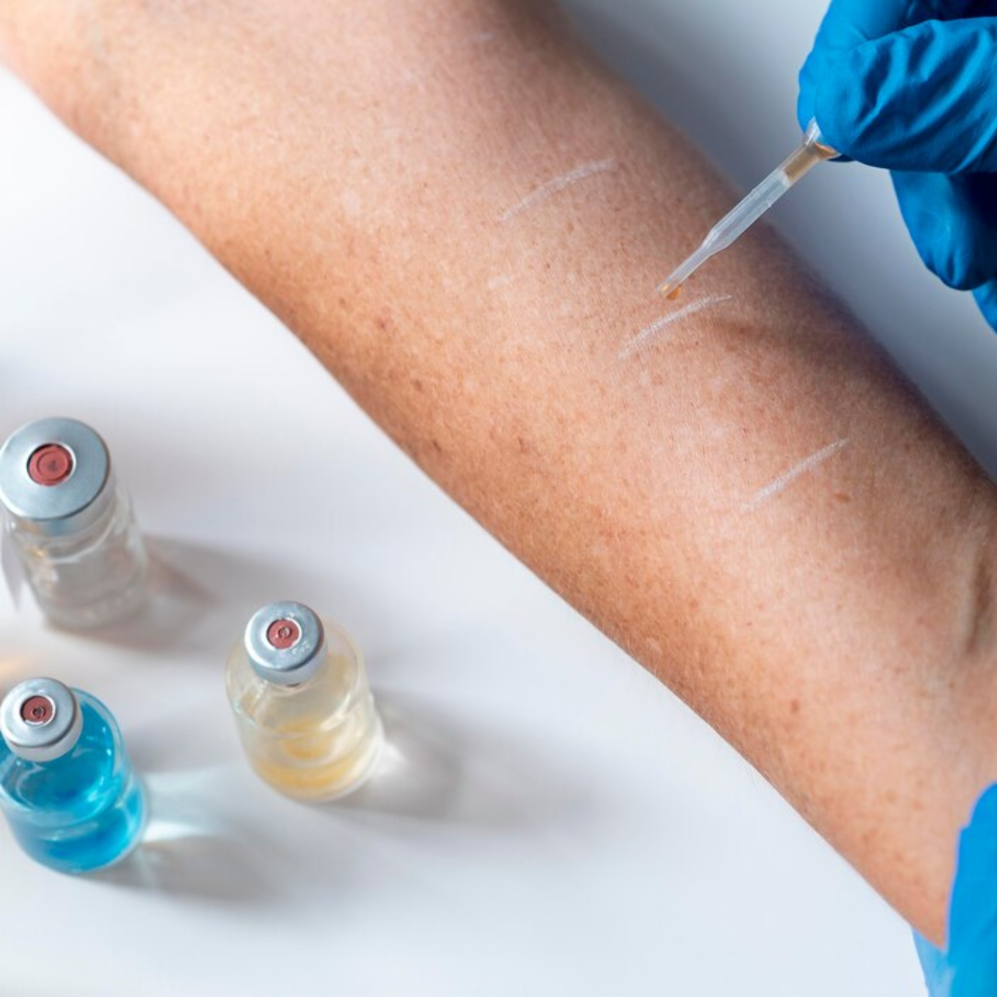 Infográfico Alergología