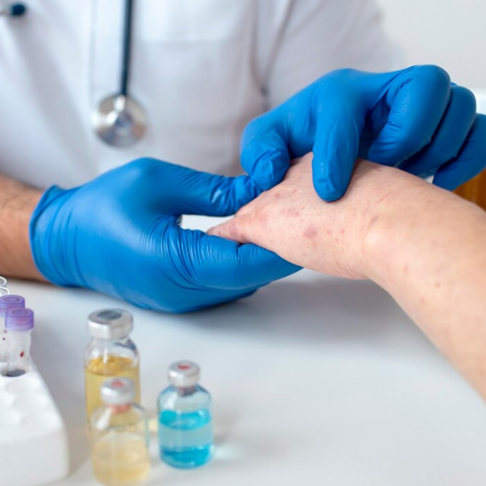 Consulta Alergología