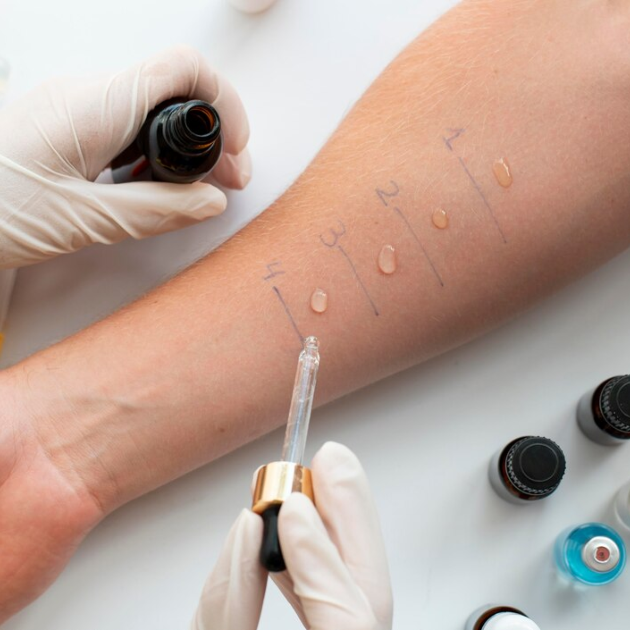 Infográfico Intraepidérmica