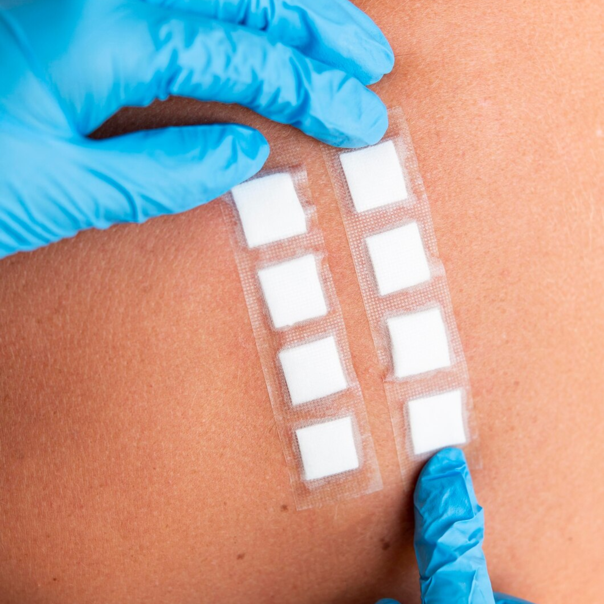 Infográfico Prueba de Parche